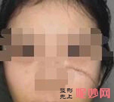 南京連天美美容醫院可以祛（qū）疤痕嗎？