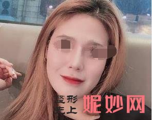 南京連天美美容醫院怎麽樣？能做激光祛斑嗎？附激光祛斑案例和價格表（biǎo）！