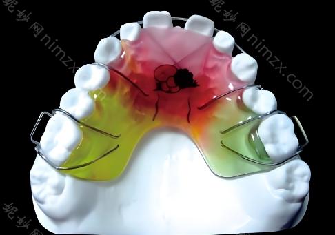 兒童牙間（jiān）隙（xì）保持器全解析：種類及價格分享