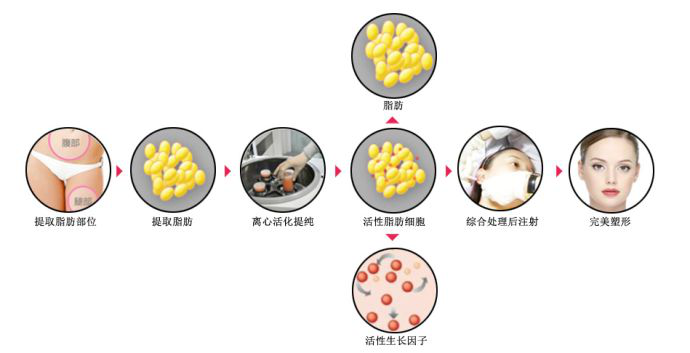 哈爾（ěr）濱歐蘭仁美醫院：全麵（miàn）部填充一（yī）次體（tǐ）驗 即可定格麵部美麗